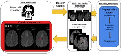 A Clinically-Compatible Workflow for Computer-Aided Assessment of Brain Disease Activity in Multiple Sclerosis Patients